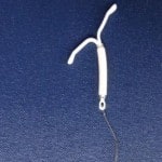 Hormonspirale: mangelnde Aufklärung und viele Nebenwirkungen 1_Mirena_cropped